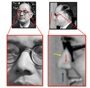 A secondary side profile image that Millar reviewed specifically to identify the nasal features